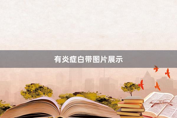 有炎症白带图片展示