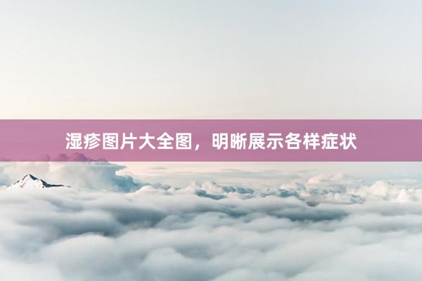 湿疹图片大全图，明晰展示各样症状